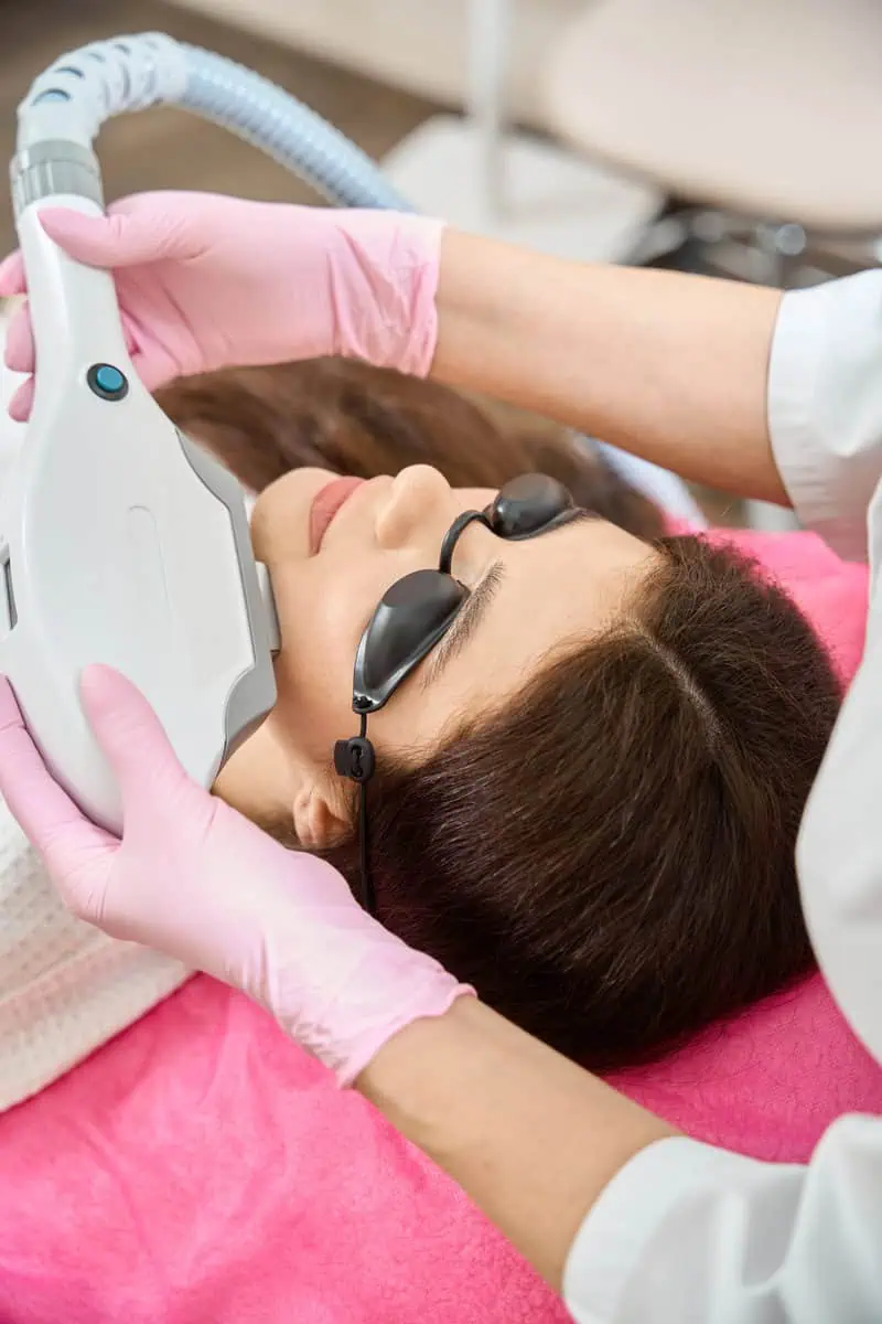 IPL Photofacial