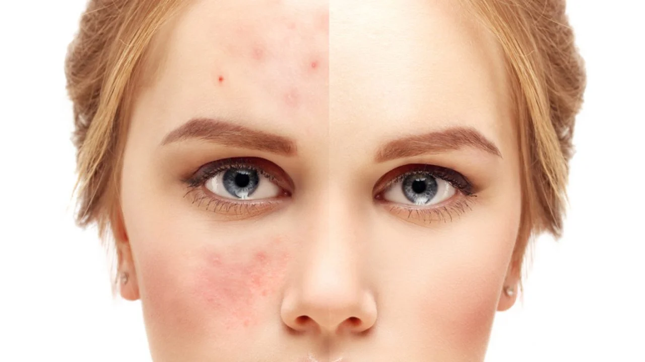 Face Reality Acne Clinic