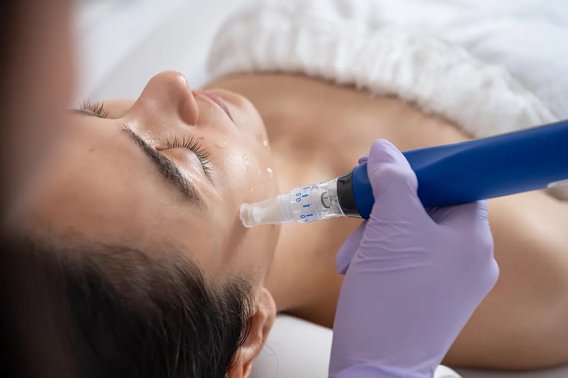 Skinpen Microneedling by Fuse Medspa & Wellness in Avon, CT