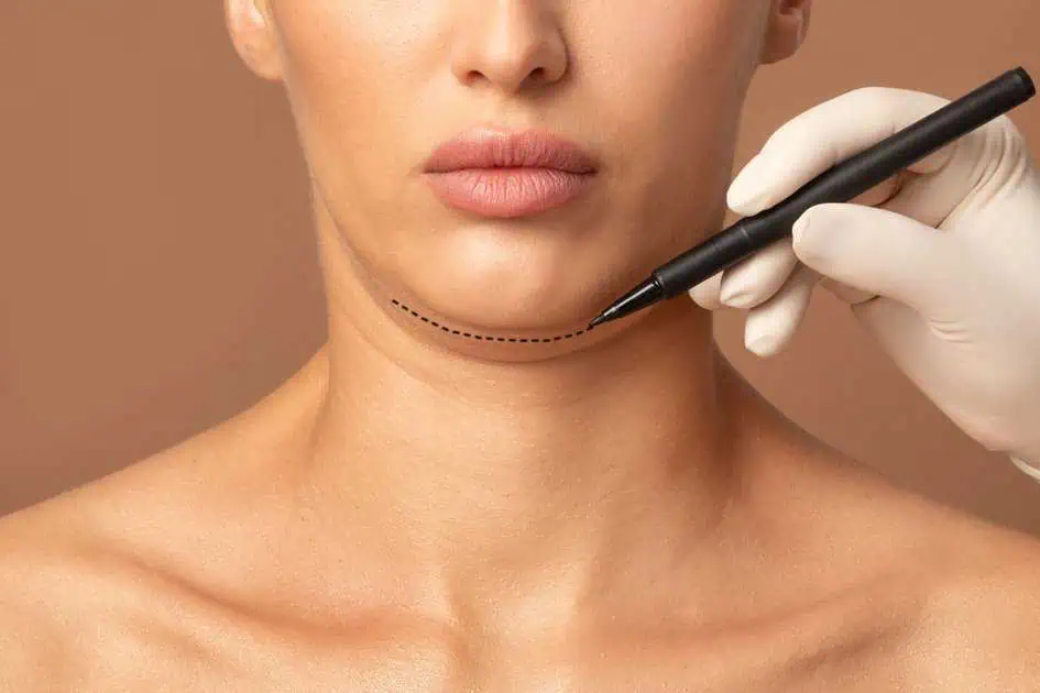 Best Kybella in Avon, CT | Fuse Medspa & Wellness