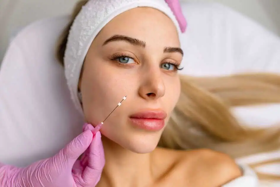 PDO Threads In Avon, CT by Ethos Medical Aesthetics & Wellness LLC DBA Fuse Medspa & Wellness